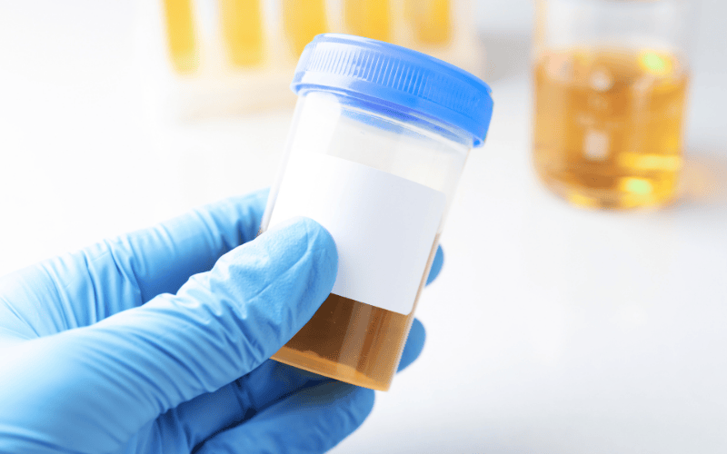 Urine Drug Test: Debunking Common Myths