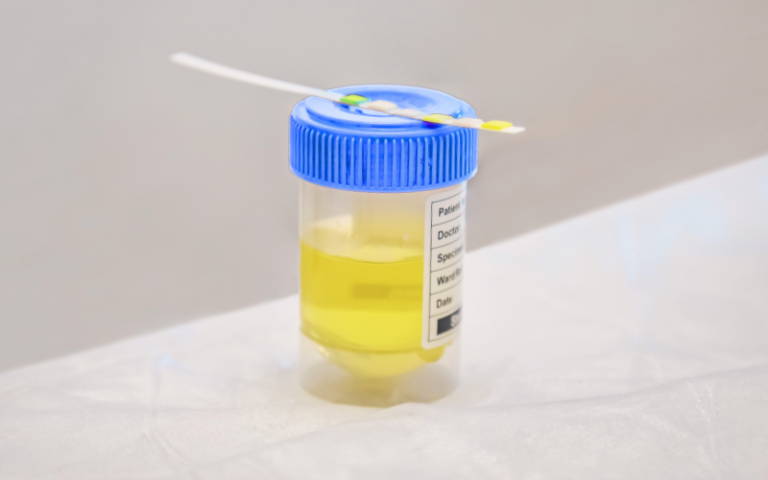 How Long Does a Urine Drug Test Take And Why the Wait Matters at Work